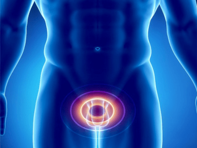 Prostatite – infiammazione della ghiandola prostatica in un uomo
